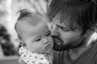 孕期乳晕变黑变大和长副乳怎么消除？